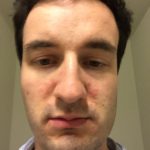 Before - March 2016 - 2